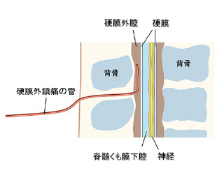 管の付近を拡大した図